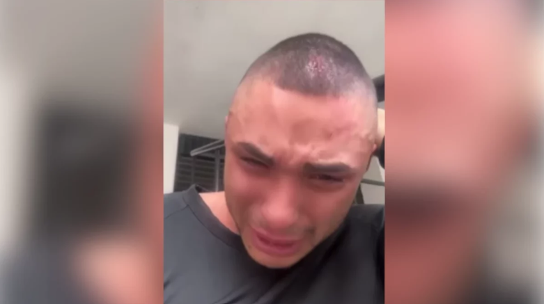 Ataque homofóbico en San Juan: Pareja gay es brutalmente agredida por empleados de un taller de motos