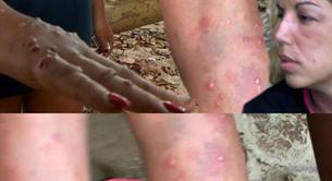 Todos los 'Supervivientes' 2014 de Playa Uva, evacuados por plaga de mosquitos