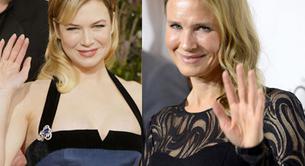 La irreconocible, operada y nueva cara de Renée Zellweger