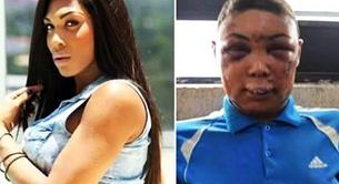 Una transexual, golpeada y desfigurada en Brasil